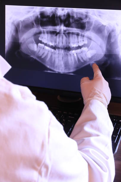 Best Emergency Dental Care for Sports Injuries in Fremont, OH